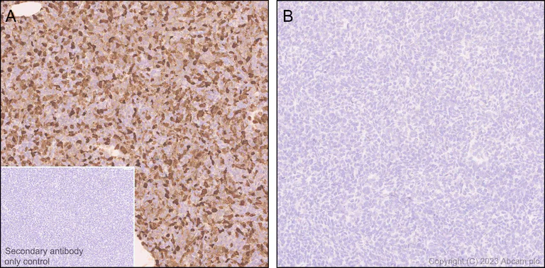 Immunohistochemistry (Formalin/PFA-fixed paraffin-embedded sections) - Anti-Indoleamine 2, 3-dioxygenase antibody [EPR28349-89] - BSA and Azide free (AB311848)