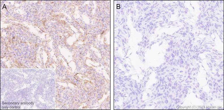 Immunohistochemistry (Formalin/PFA-fixed paraffin-embedded sections) - Anti-Indoleamine 2, 3-dioxygenase antibody [EPR28349-89] - BSA and Azide free (AB311848)