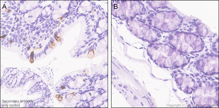 Immunohistochemistry (Formalin/PFA-fixed paraffin-embedded sections) - Anti-Indoleamine 2, 3-dioxygenase antibody [EPR28349-89] - BSA and Azide free (AB311848)