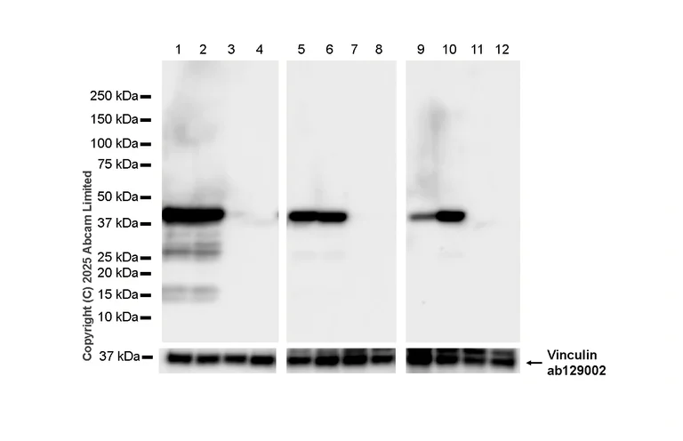 Western blot - Anti-Indoleamine 2, 3-dioxygenase antibody [EPR28349-89] - BSA and Azide free (AB311848)
