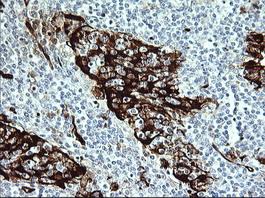 Immunohistochemistry (Formalin/PFA-fixed paraffin-embedded sections) - Anti-Indoleamine 2, 3-dioxygenase antibody [OTI1A3] (ab156787), expandable thumbnail