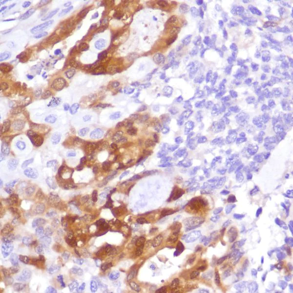 Immunohistochemistry (Formalin/PFA-fixed paraffin-embedded sections) - Anti-Indoleamine 2, 3-dioxygenase antibody [SP260] - BSA and Azide free (AB245737)