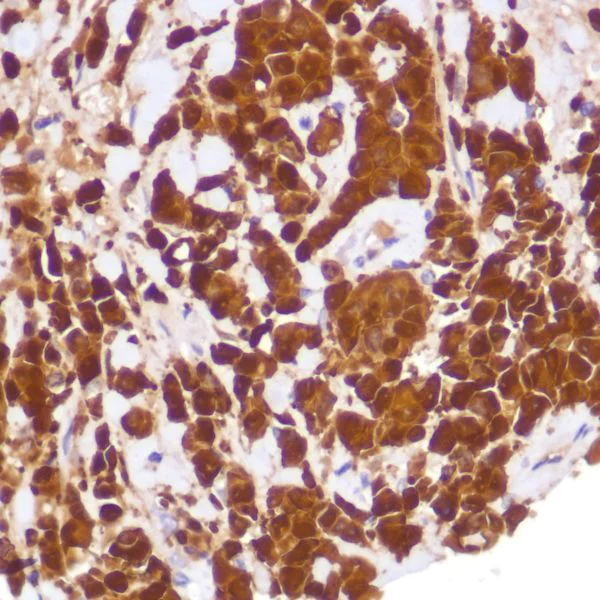 Immunohistochemistry (Formalin/PFA-fixed paraffin-embedded sections) - Anti-Indoleamine 2, 3-dioxygenase antibody [SP260] - C-terminal (AB228468)