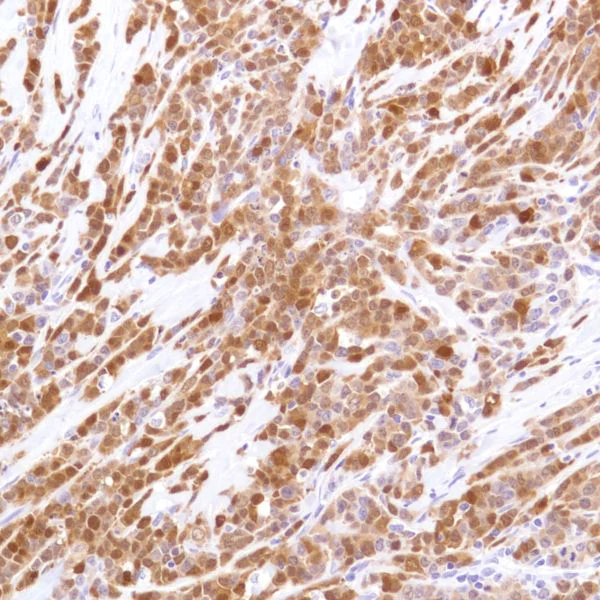 Immunohistochemistry (Formalin/PFA-fixed paraffin-embedded sections) - Anti-Indoleamine 2, 3-dioxygenase antibody [SP277] - BSA and Azide free (AB238785)