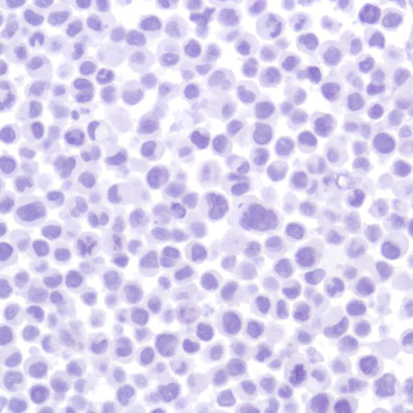 Immunohistochemistry (Formalin/PFA-fixed paraffin-embedded sections) - Anti-Indoleamine 2, 3-dioxygenase antibody [SP277] - BSA and Azide free (AB238785)