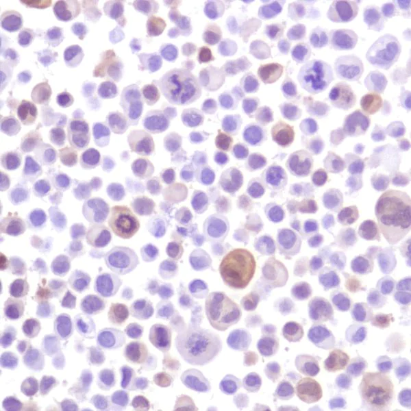 Immunohistochemistry (Formalin/PFA-fixed paraffin-embedded sections) - Anti-Indoleamine 2, 3-dioxygenase antibody [SP277] - BSA and Azide free (AB238785)