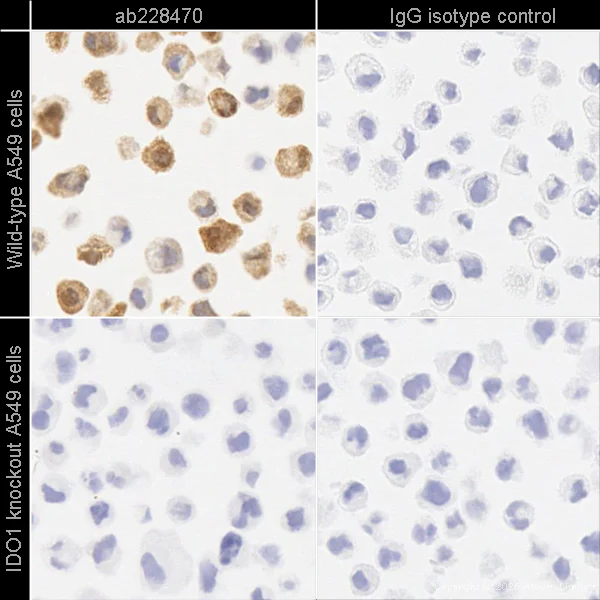Immunohistochemistry (Formalin/PFA-fixed paraffin-embedded sections) - Anti-Indoleamine 2, 3-dioxygenase antibody [SP277] - BSA and Azide free (AB238785)