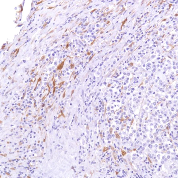 Immunohistochemistry (Formalin/PFA-fixed paraffin-embedded sections) - Anti-Indoleamine 2, 3-dioxygenase antibody [SP277] - BSA and Azide free (AB238785)