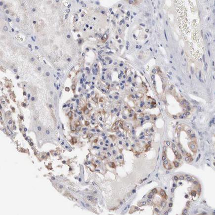 Immunohistochemistry (Formalin/PFA-fixed paraffin-embedded sections) - Anti-INF2 antibody (AB121114)