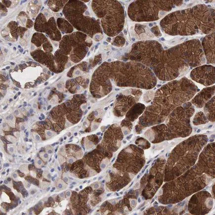 Immunohistochemistry (Formalin/PFA-fixed paraffin-embedded sections) - Anti-INF2 antibody (AB121114)