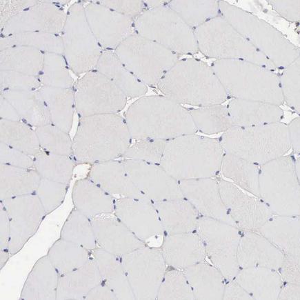 Immunohistochemistry (Formalin/PFA-fixed paraffin-embedded sections) - Anti-INF2 antibody (AB121114)
