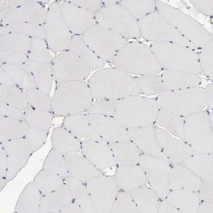 Immunohistochemistry (Formalin/PFA-fixed paraffin-embedded sections) - Anti-INF2 antibody (AB121114)
