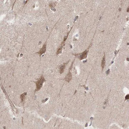 Immunohistochemistry (Formalin/PFA-fixed paraffin-embedded sections) - Anti-INF2 antibody (AB121114)
