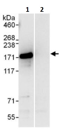 Immunoprecipitation - Anti-INF2 antibody (AB245555)