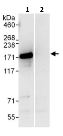 Immunoprecipitation - Anti-INF2 antibody (AB245555)