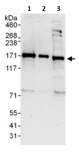 Western blot - Anti-INF2 antibody (AB245555)