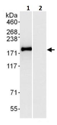 Immunoprecipitation - Anti-INF2 antibody (AB245556)