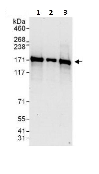 Western blot - Anti-INF2 antibody (AB245556)