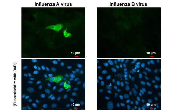 Immunocytochemistry/ Immunofluorescence - Anti-Influenza A virus H1N1 NA Neuraminidase antibody [HL1108] (AB308340)