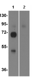 Western blot - Anti-Influenza A Virus Hemagglutinin H1 antibody (AB91531)