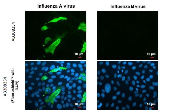 Immunocytochemistry/ Immunofluorescence - Anti-Influenza A virus M1 matrix protein antibody [HL1273] (AB308354), expandable thumbnail