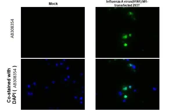 Immunohistochemistry (Formalin/PFA-fixed paraffin-embedded sections) - Anti-Influenza A virus M1 matrix protein antibody [HL1273] (AB308354), expandable thumbnail