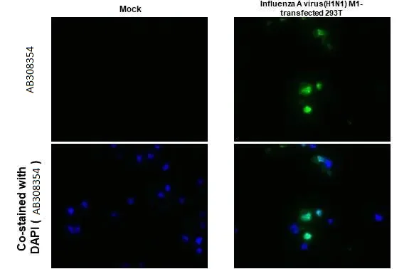 Immunohistochemistry (Formalin/PFA-fixed paraffin-embedded sections) - Anti-Influenza A virus M1 matrix protein antibody [HL1273] (AB308354)