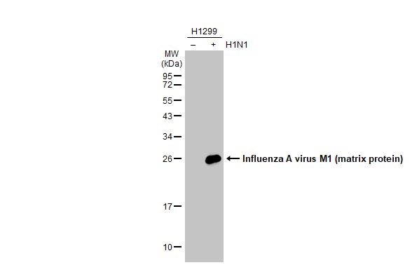 Western blot - Anti-Influenza A virus M1 matrix protein antibody [HL1273] (AB308354), expandable thumbnail