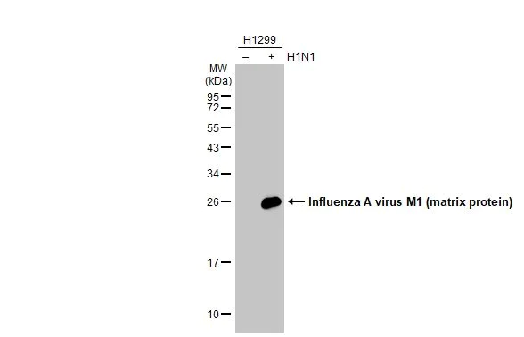 Western blot - Anti-Influenza A virus M1 matrix protein antibody [HL1273] (AB308354)