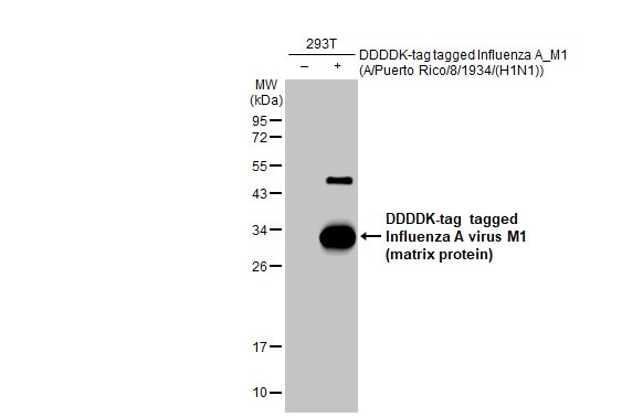 Western blot - Anti-Influenza A virus M1 matrix protein antibody [HL1273] (AB308354), expandable thumbnail