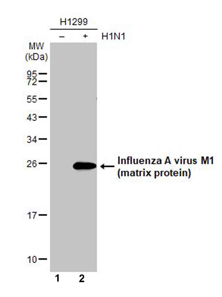 Western blot - Anti-Influenza A virus M1 (matrix protein) antibody [HL1275] (AB306544), expandable thumbnail