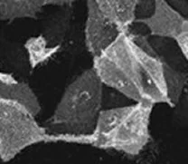 Immunocytochemistry - Anti-Influenza A Virus M2 Protein antibody [14C2] (AB5416)