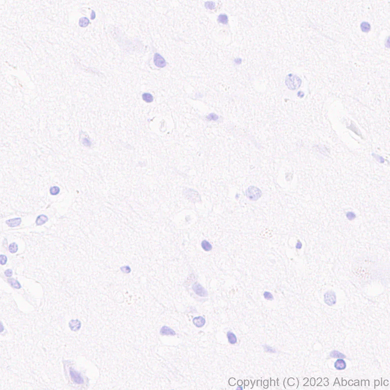 Immunohistochemistry (Formalin/PFA-fixed paraffin-embedded sections) - Anti-Influenza A Virus M2 Protein antibody [EPR28252-11] (AB313889)