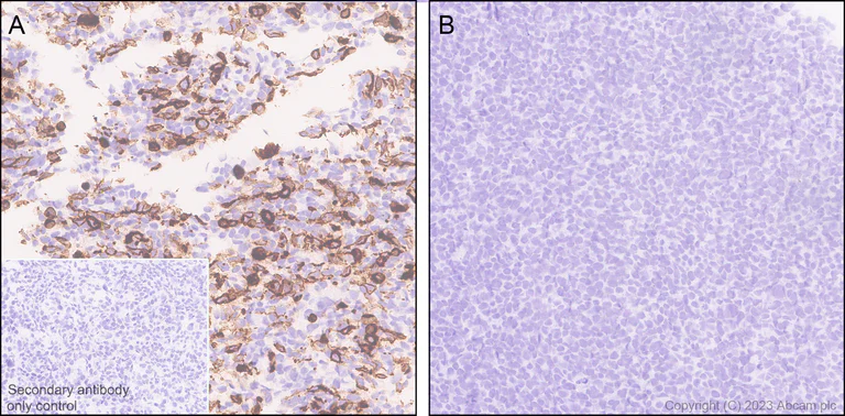 Immunohistochemistry (Formalin/PFA-fixed paraffin-embedded sections) - Anti-Influenza A Virus M2 Protein antibody [EPR28252-11] - BSA and Azide free (AB313890)