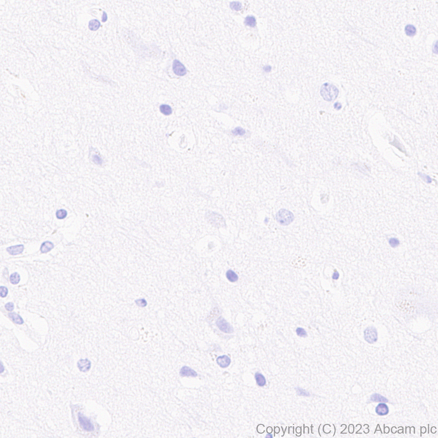 Immunohistochemistry (Formalin/PFA-fixed paraffin-embedded sections) - Anti-Influenza A Virus M2 Protein antibody [EPR28252-11] - BSA and Azide free (AB313890), expandable thumbnail