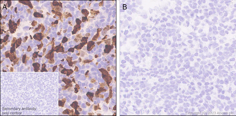 Immunohistochemistry (Formalin/PFA-fixed paraffin-embedded sections) - Anti-Influenza A virus NS1 protein antibody [EPR28247-51] (AB313341)