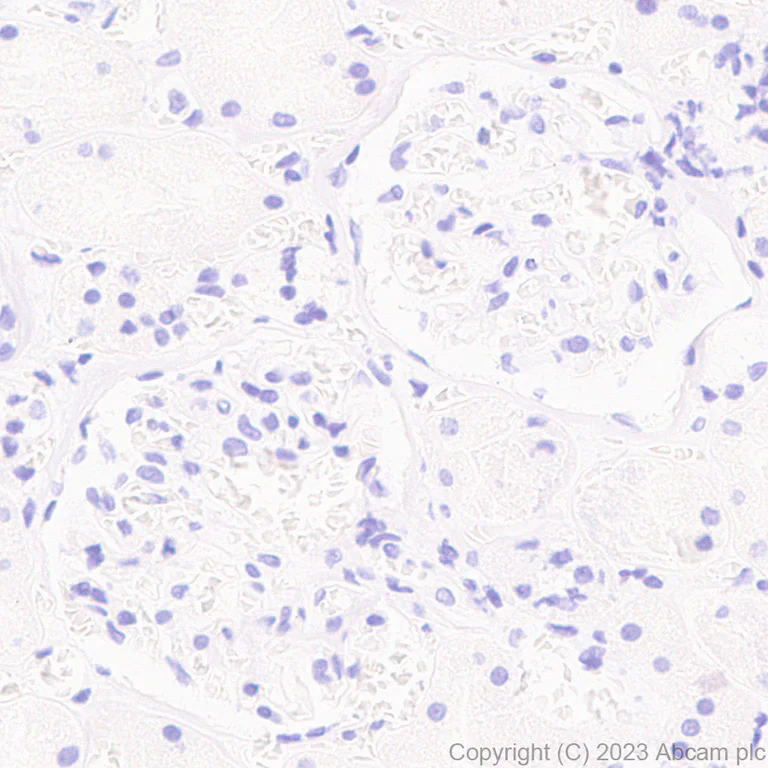 Immunohistochemistry (Formalin/PFA-fixed paraffin-embedded sections) - Anti-Influenza A virus NS1 protein antibody [EPR28247-51] (AB313341)