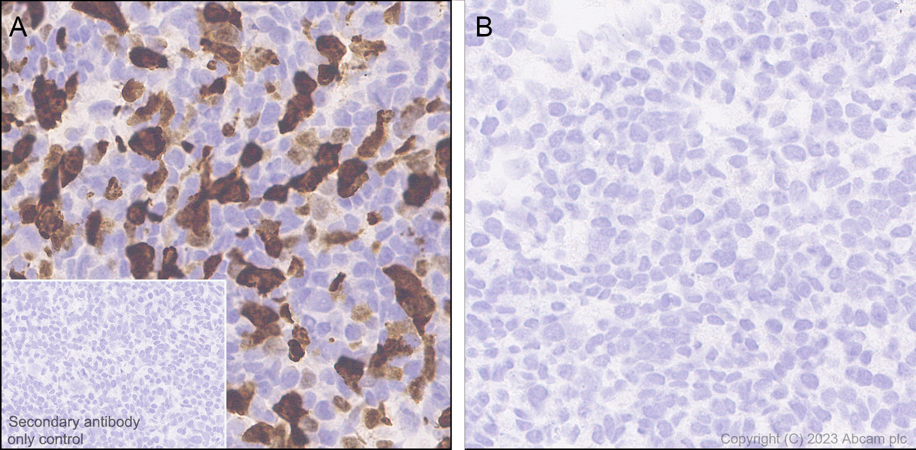 Immunohistochemistry (Formalin/PFA-fixed paraffin-embedded sections) - Anti-Influenza A virus NS1 protein antibody [EPR28247-51] - BSA and Azide free (ab313342), expandable thumbnail