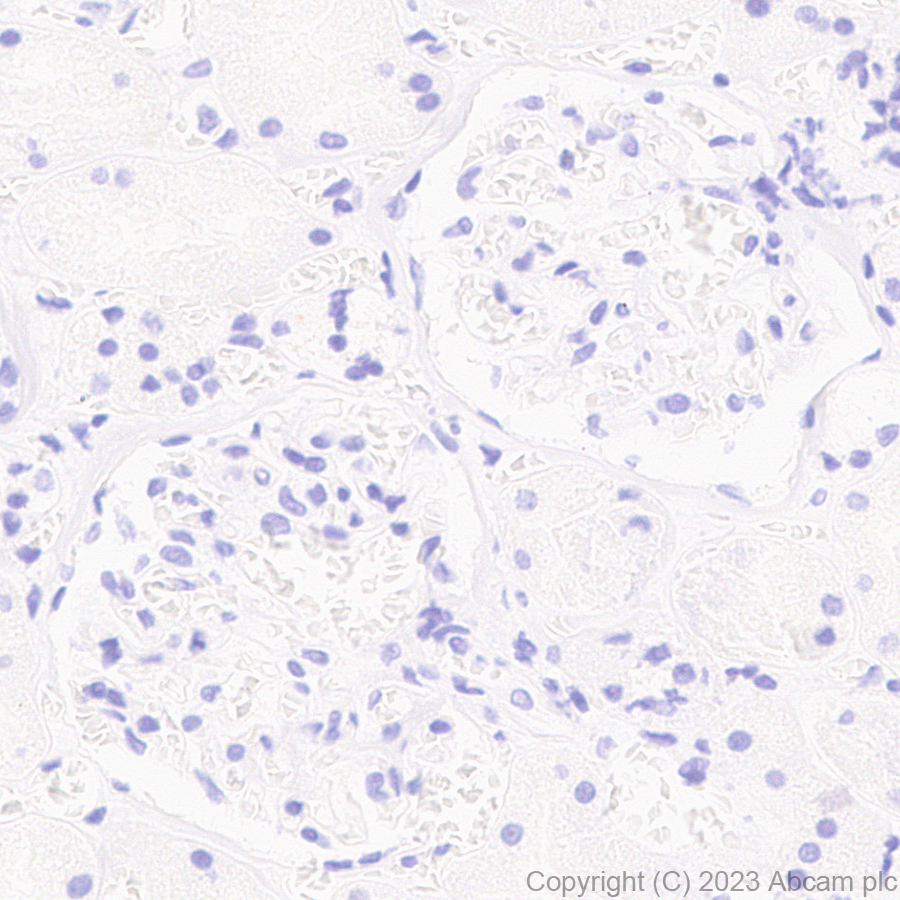 Immunohistochemistry (Formalin/PFA-fixed paraffin-embedded sections) - Anti-Influenza A virus NS1 protein antibody [EPR28247-51] - BSA and Azide free (ab313342), expandable thumbnail