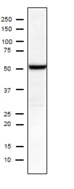 Western blot - Anti-Influenza A Virus Nucleoprotein antibody [C43] (AB128193), expandable thumbnail