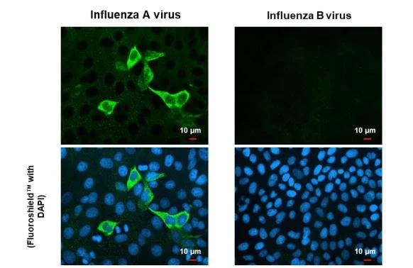 Immunocytochemistry/ Immunofluorescence - Anti-Influenza A virus Nucleoprotein antibody [HL1089] (AB308393)