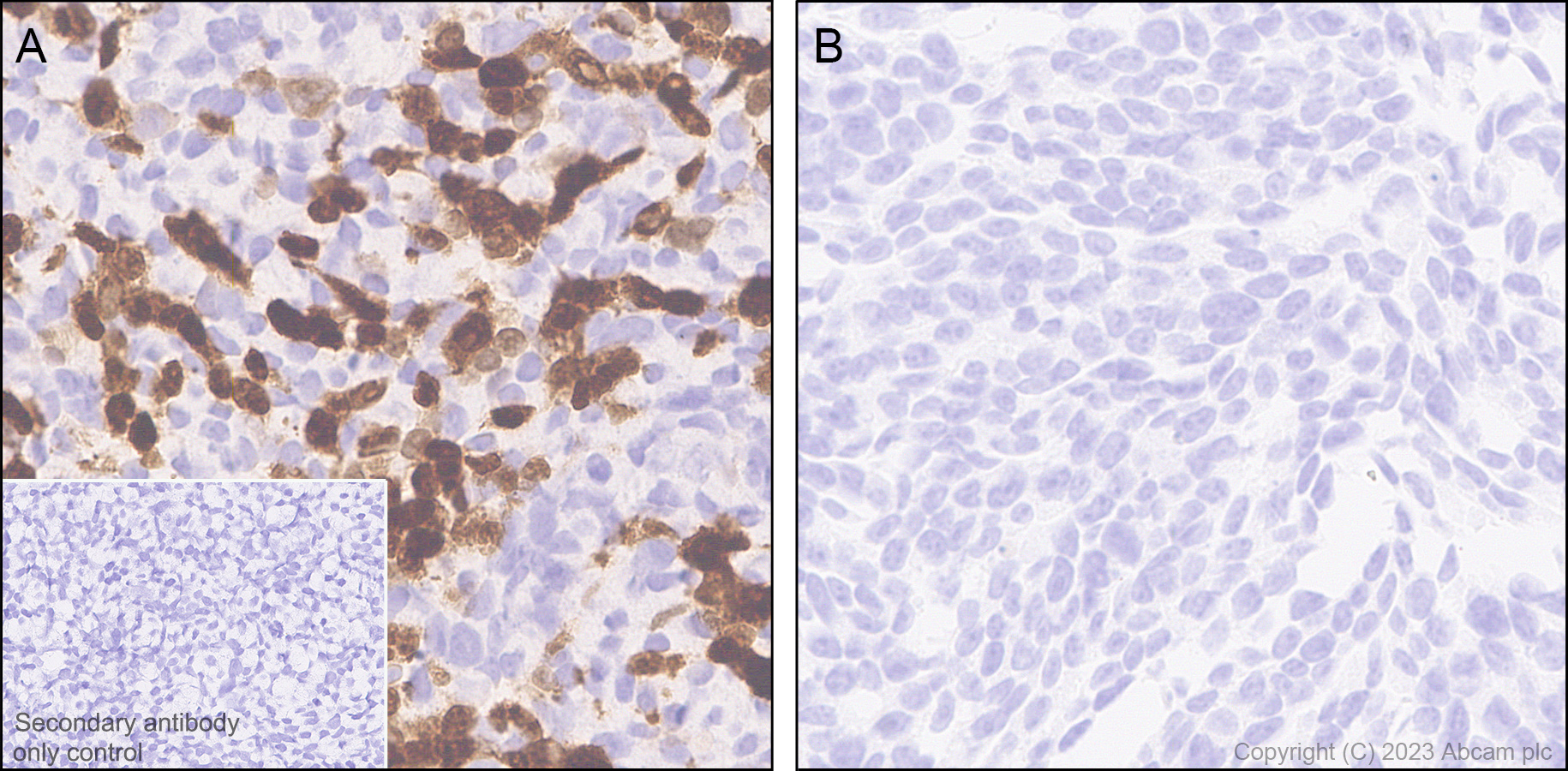 Immunohistochemistry (Formalin/PFA-fixed paraffin-embedded sections) - Anti-Influenza A Virus PA protein antibody [EPR28250-39] (AB313745), expandable thumbnail
