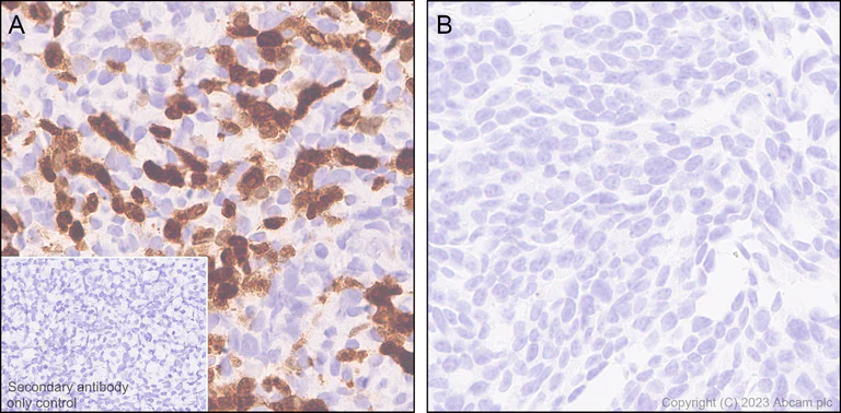 Immunohistochemistry (Formalin/PFA-fixed paraffin-embedded sections) - Anti-Influenza A Virus PA protein antibody [EPR28250-39] (AB313745)