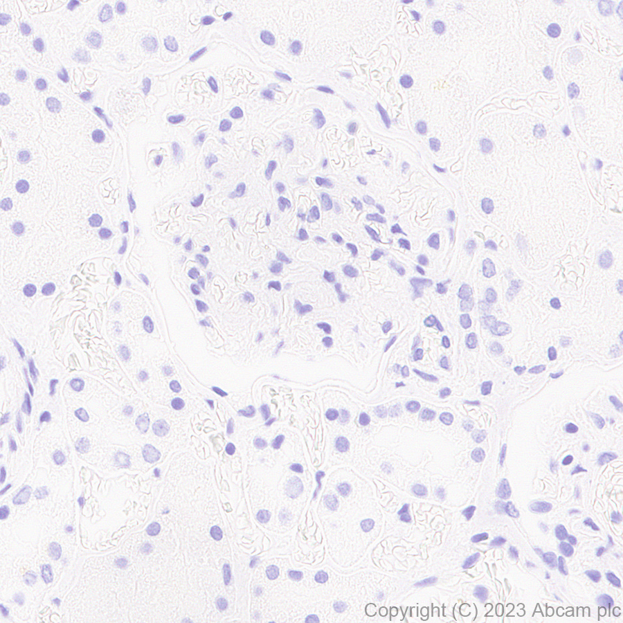 Immunohistochemistry (Formalin/PFA-fixed paraffin-embedded sections) - Anti-Influenza A Virus PA protein antibody [EPR28250-39] (AB313745), expandable thumbnail