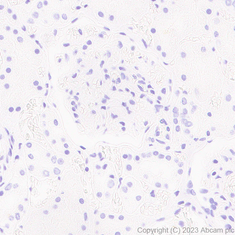 Immunohistochemistry (Formalin/PFA-fixed paraffin-embedded sections) - Anti-Influenza A Virus PA protein antibody [EPR28250-39] (AB313745)