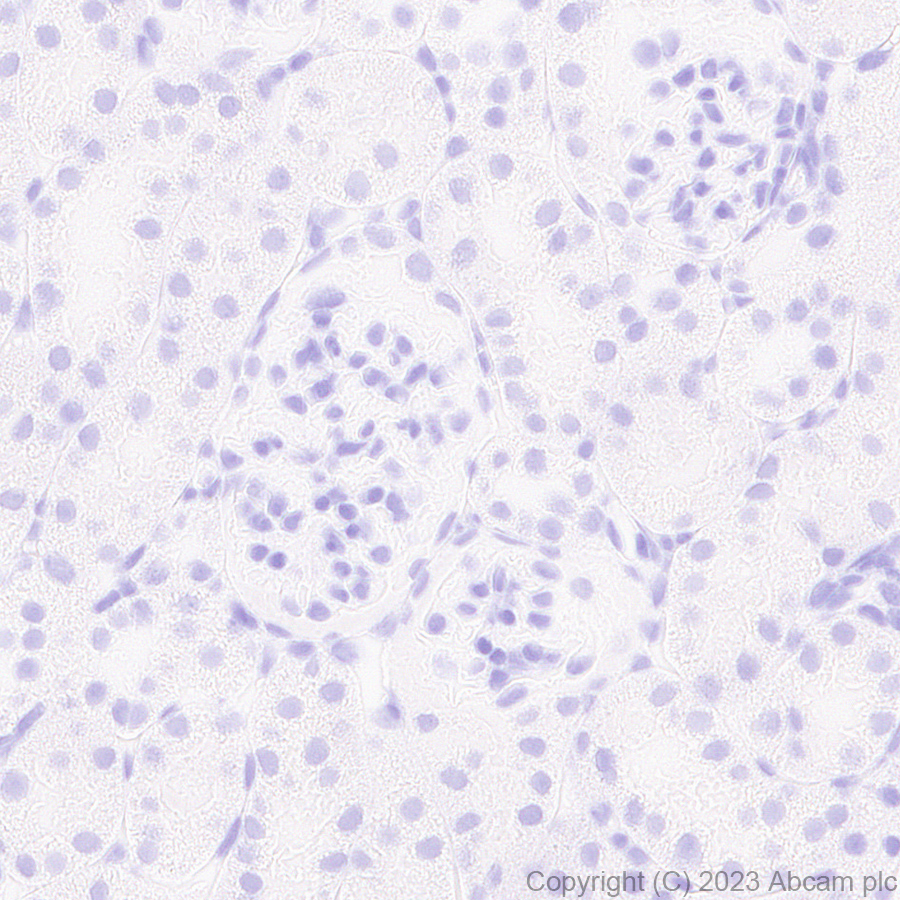 Immunohistochemistry (Formalin/PFA-fixed paraffin-embedded sections) - Anti-Influenza A Virus PA protein antibody [EPR28250-39] (AB313745), expandable thumbnail