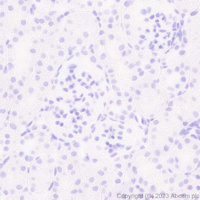 Immunohistochemistry (Formalin/PFA-fixed paraffin-embedded sections) - Anti-Influenza A Virus PA protein antibody [EPR28250-39] (AB313745)