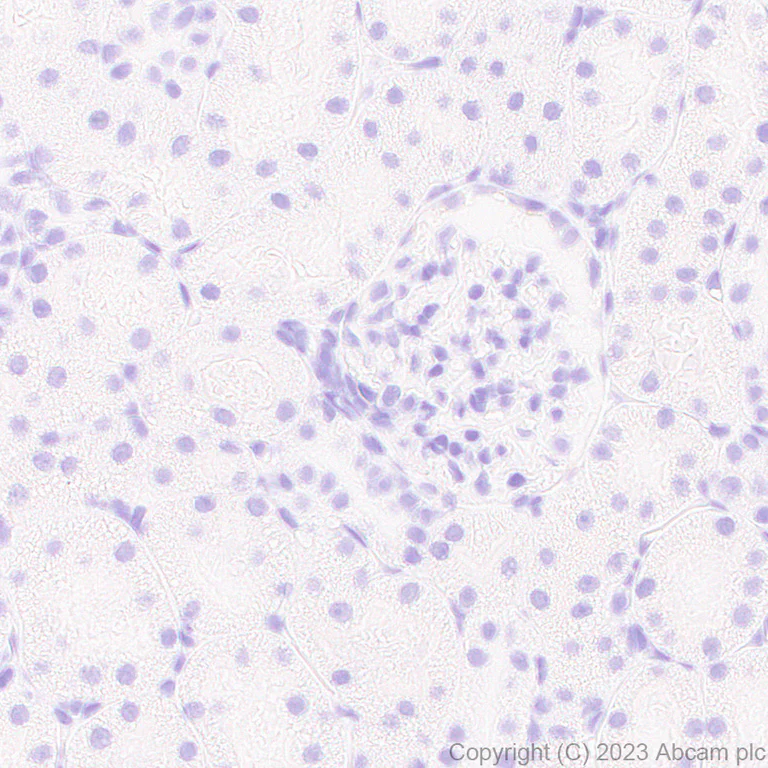 Immunohistochemistry (Formalin/PFA-fixed paraffin-embedded sections) - Anti-Influenza A Virus PA protein antibody [EPR28250-39] (AB313745)
