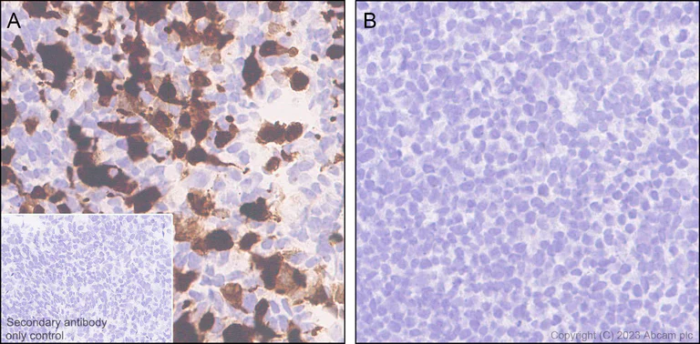 Immunohistochemistry (Formalin/PFA-fixed paraffin-embedded sections) - Anti-Influenza A virus PB1 antibody [EPR28248-26] (AB313887)