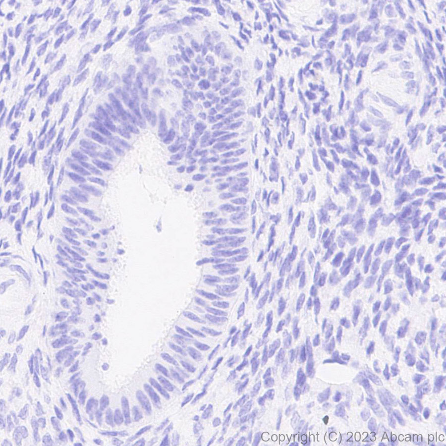 Immunohistochemistry (Formalin/PFA-fixed paraffin-embedded sections) - Anti-Influenza A virus PB1 antibody [EPR28248-26] (AB313887)